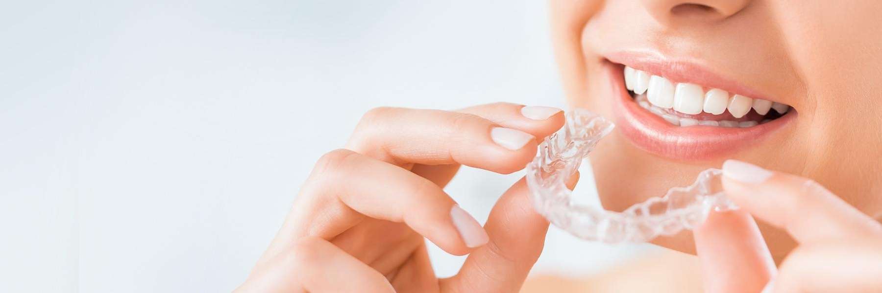 Clear Aligners | Dentist
